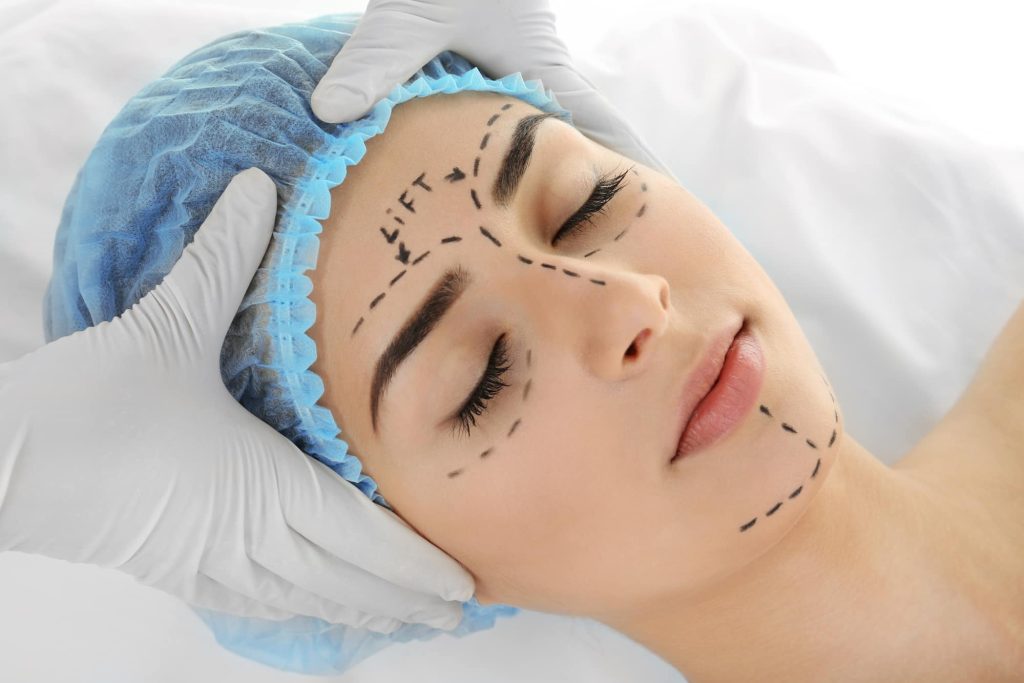 woman's face marked for plastic surgery
