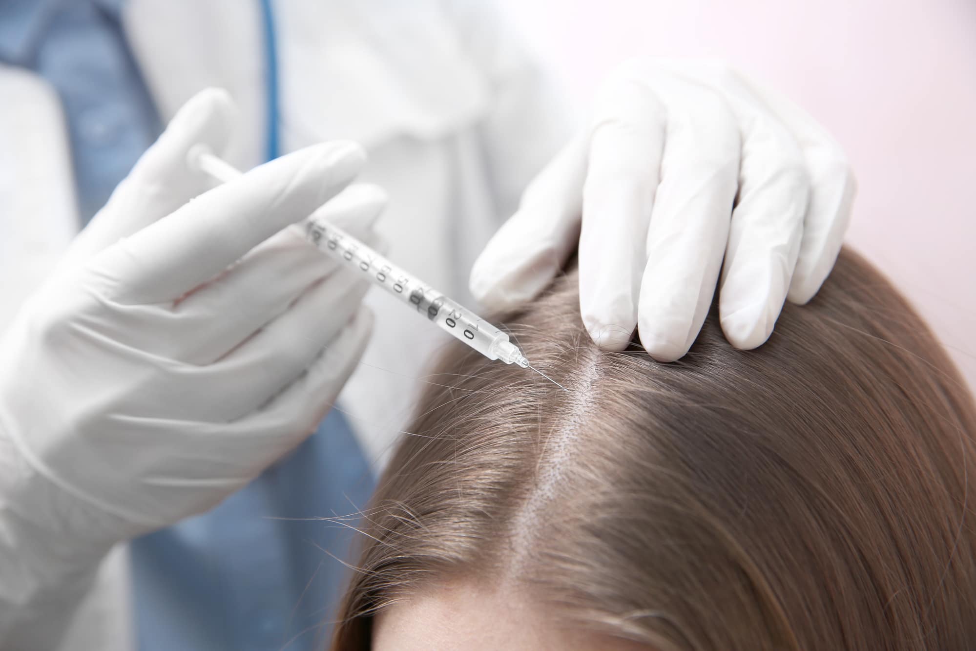 woman getting mesotherapy injection in scalp